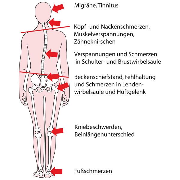 Funktionsdiagnostik / CMD